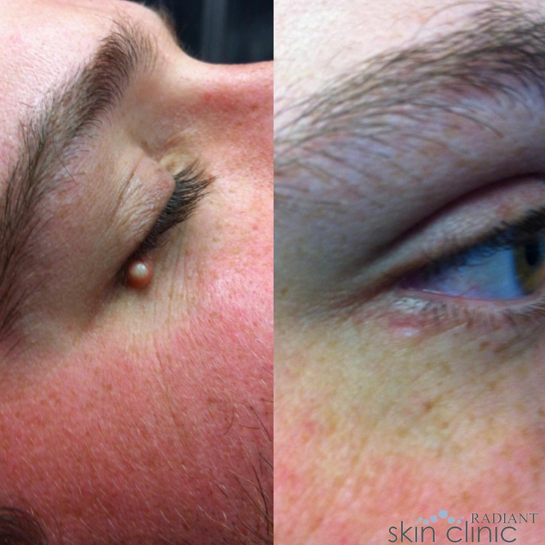 Lamprobe 2 - Radiant resized