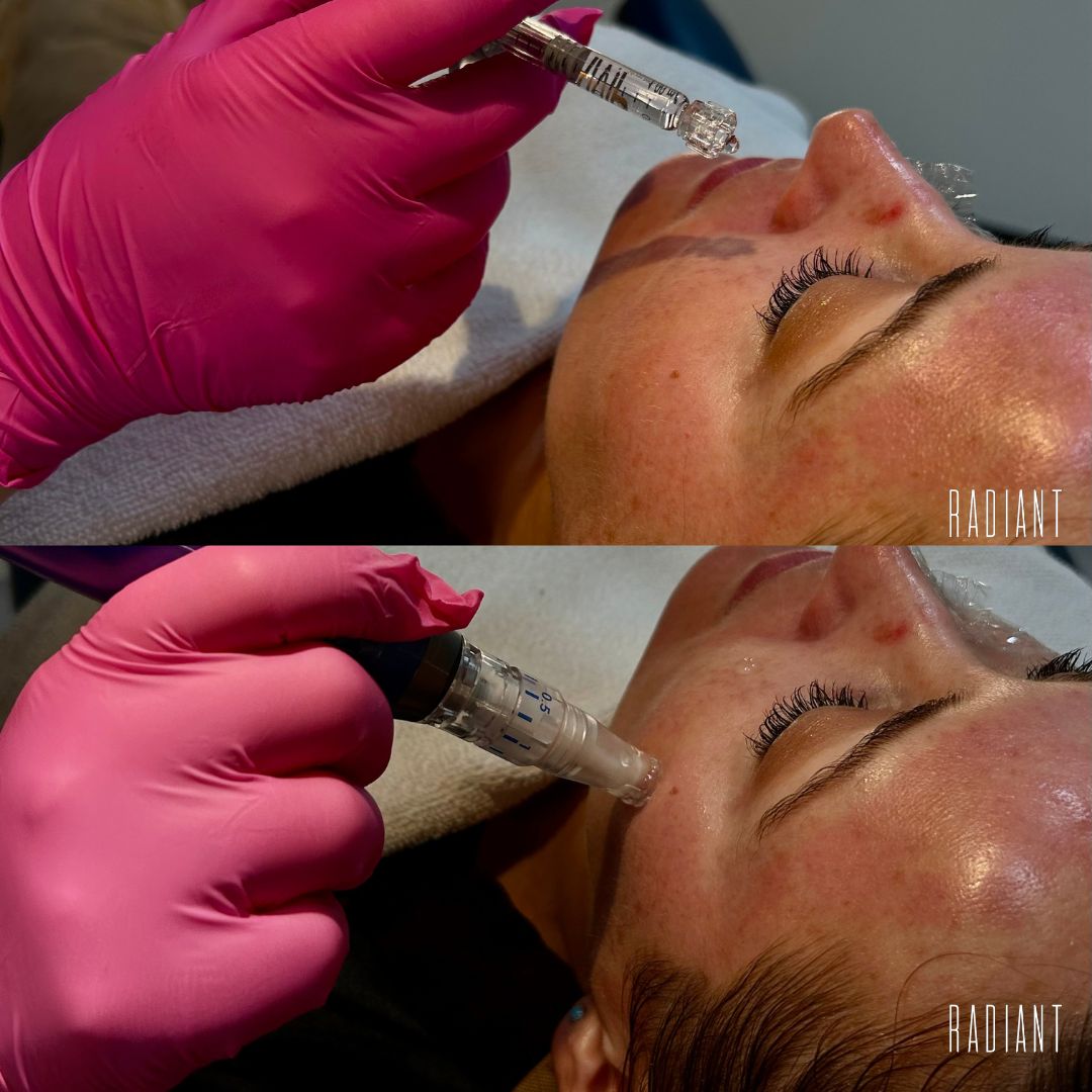 sarah hydrafacial